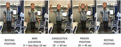 Forearm Volume Changes Estimated by Photo-Plethysmography During an Original Candlestick/Prayer Maneuver in Patients With Suspected Thoracic Outlet Syndrome